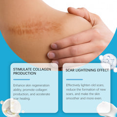 Scar Repair CreamScar Repair Cream